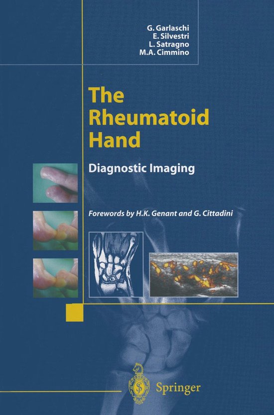 Medicine (R0) - The Rheumatoid Hand - cover