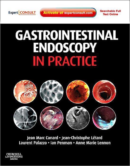 Gastrointestinal Endoscopy In Practice EBook (ebook), Jean Canard