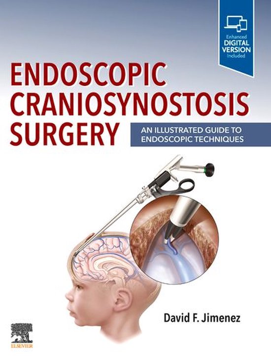 Endoscopic Craniosynostosis Surgery E-Book - cover