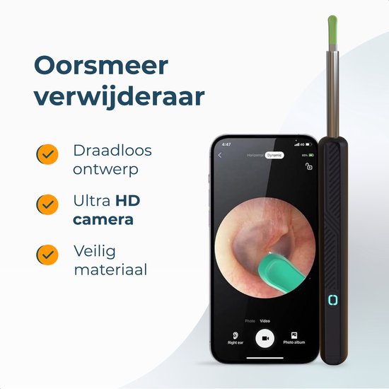 Alyze Extracteur de cérumen avec caméra - Nettoyeur d'oreilles - Seringue - Nettoyage - Nettoyeur Ear - Grattoir - Douche - Caméra - Nettoyage des oreilles - Cuillère