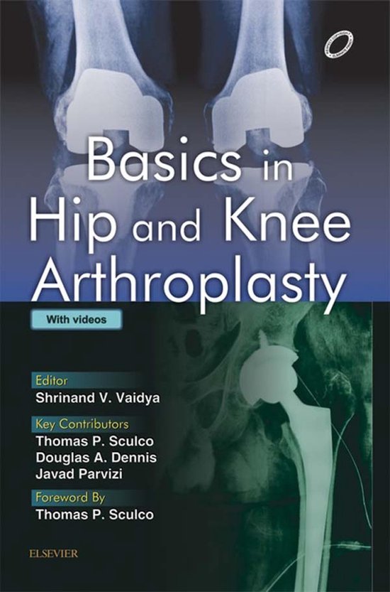 Basics in Hip and Knee Arthroplasty - E-book - cover