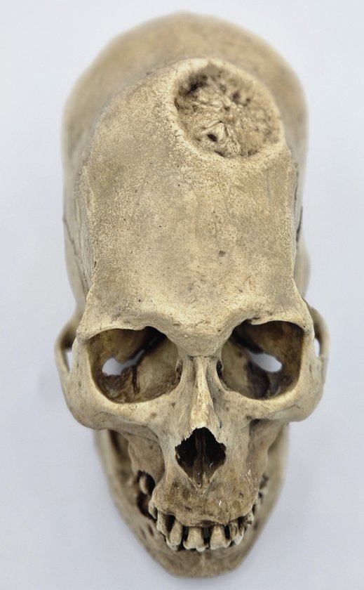 Preparatenshop replica cast schedel Peruviaanse man