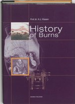 History of Burns