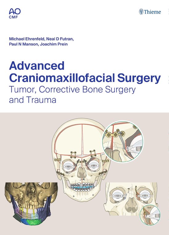 Advanced Craniomaxillofacial Surgery - cover