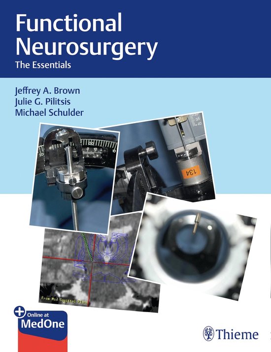 Functional Neurosurgery - cover