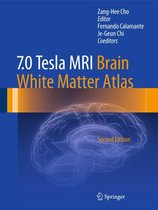 7 0 Tesla MRI Brain White Matter Atlas