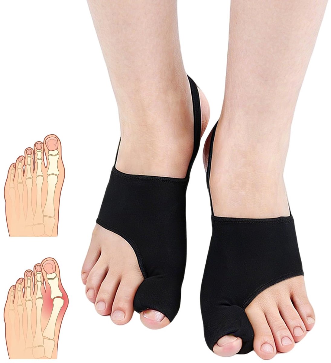 2 x Hallux Valgus corrector voor dames en heren, grote tenenslippers, zacht, ademend, voor dag en nacht, eenheidsmaat, hallux valgus-correctie, teenspreider, spalk, teenspreider, zwart