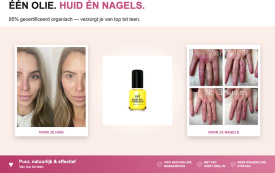 Drie afbeeldingen: Marieke met huidproblemen, flesje Dadi'Oil, handen met nagelproblemen 'voor' en 'na 3 weken'.