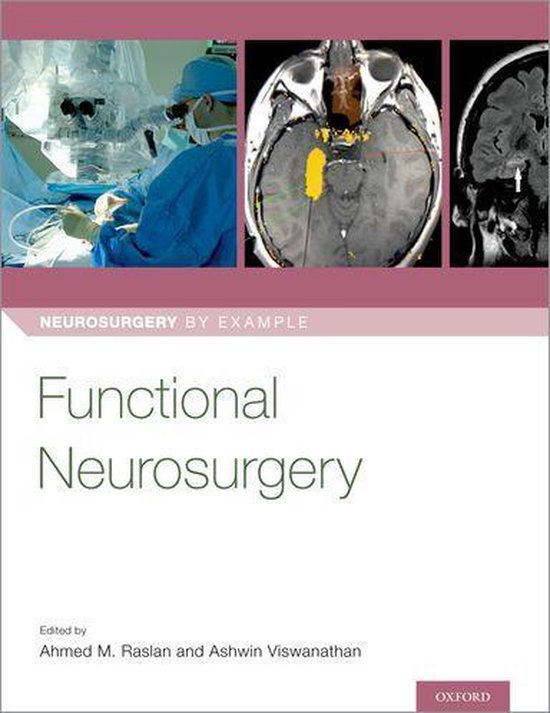 Neurosurgery by Example - Functional Neurosurgery - cover
