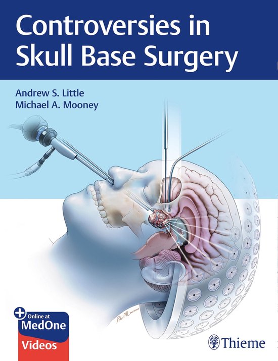 Controversies in Skull Base Surgery - cover
