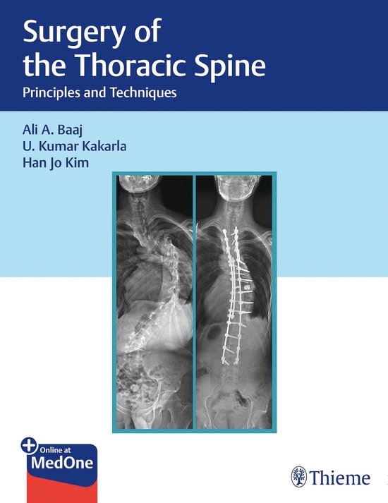 Surgery of the Thoracic Spine - cover