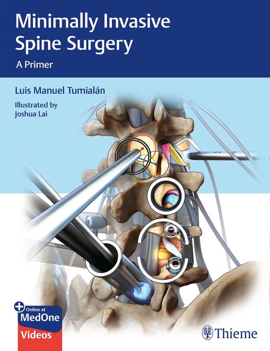 Minimally Invasive Spine Surgery - cover