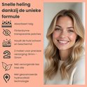 Een lachende vrouw met blond haar, met tekst over de voordelen van de puistjespatches.