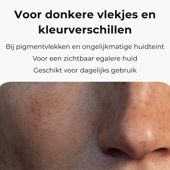 Skinlight Anti Pigment Creme - Melasma Creme - Hyperpigmentatie - Pigmentvlekken Verminderen - Ouderdomsvlekken - Brightening Cream - 60 ml