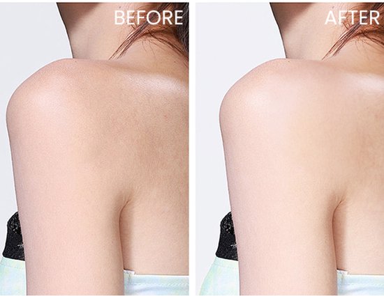 Vergelijking van een schouder voor en na het aanbrengen van de Nuxe Huile Prodigieuse multi-purpose dry oil.