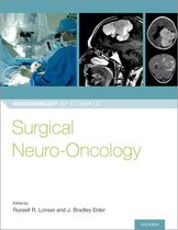 Neurosurgery by Example - Surgical Neuro-Oncology