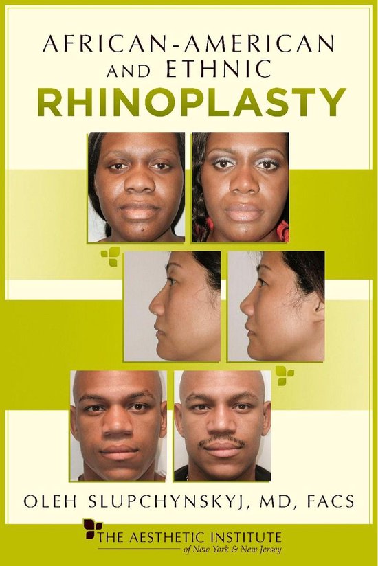 African-American and Ethnic Rhinoplasty - cover