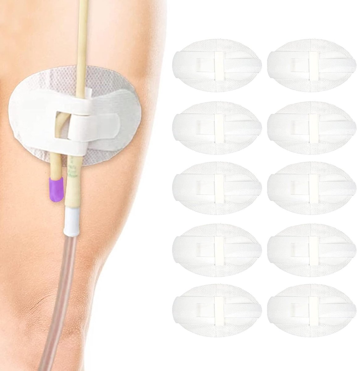 10 stuks katheter-stabilisatieapparaat, urinaire beenzak beenriem houder stickers, statlock foley katheter-houder, zelfklevende katheter-benodigdheden voor single/double tube, G tube en voedingsbuis