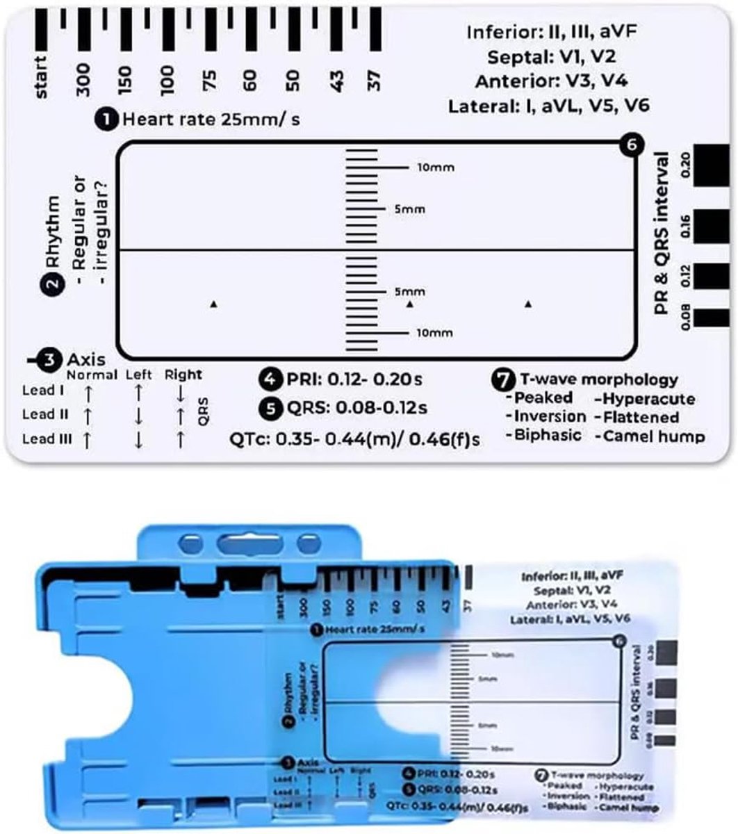 ECG liniaal 8.6cm x 5.3cm - transparant - vereenvoudigde ECG-kaart - ideaal voor studenten en zorgverleners - ShopVlot