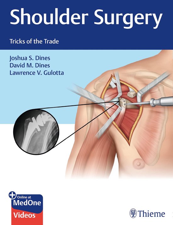 Shoulder Surgery - cover