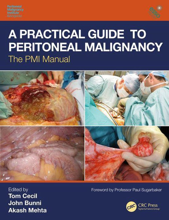 A Practical Guide to Peritoneal Malignancy - cover