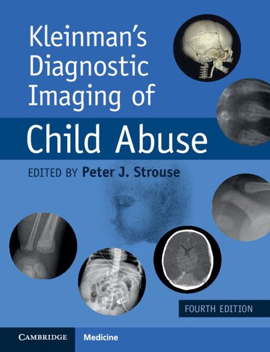Kleinman's Diagnostic Imaging of Child Abuse - cover