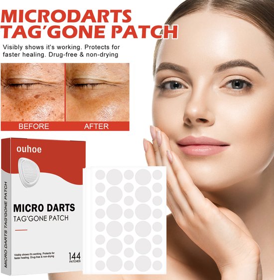 Microdarts Tag'Gone Patch – Snelle & Pijnloze Verwijdering van Skin Tags, 144 Patches zonder Medicatie