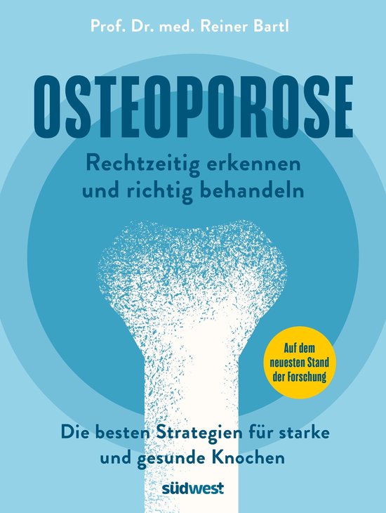 Osteoporose rechtzeitig erkennen und behandeln - cover