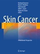 Skin Cancer A World Wide Perspective
