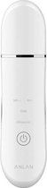 ANLAN Ultrasone huidscrubber ALDRY03-02 (wit)