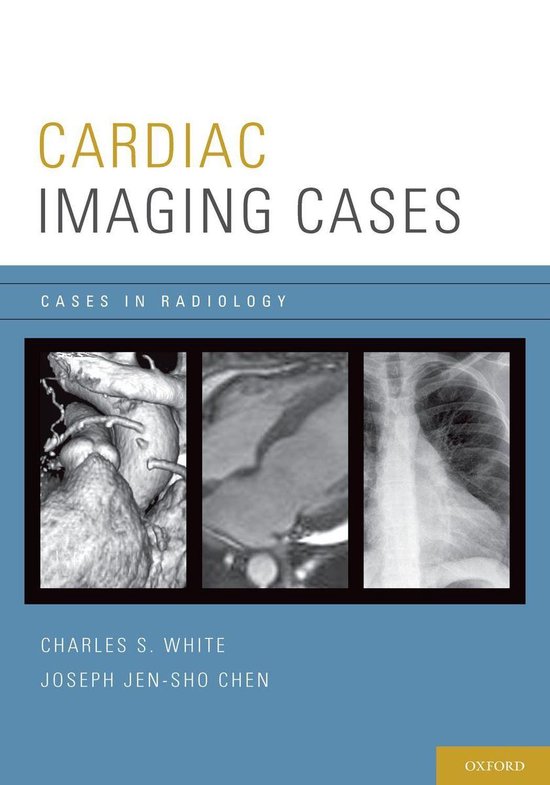 Cases in Radiology Cardiac Imaging Cases (ebook), Charles White