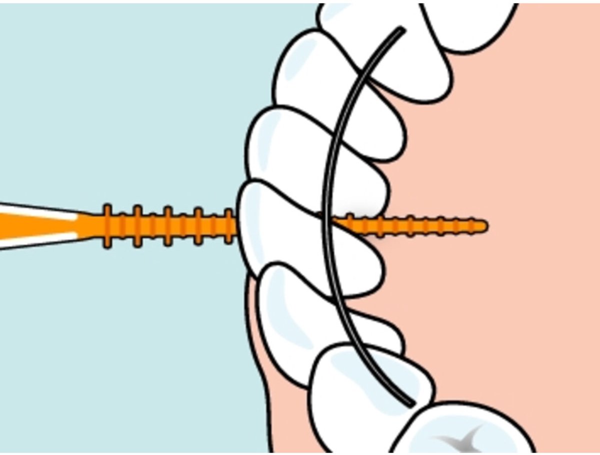 Goedkoopste TePe EasyPick - Maat XS/ S - 3 x 60 stuks