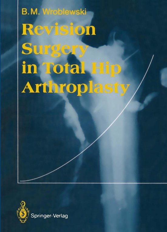 Revision Surgery in Total Hip Arthroplasty - cover