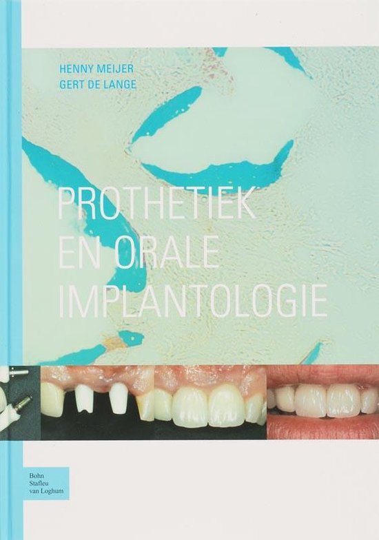 Prothetiek en orale implantologie - H Meijer | Tiliboo-afrobeat.com
