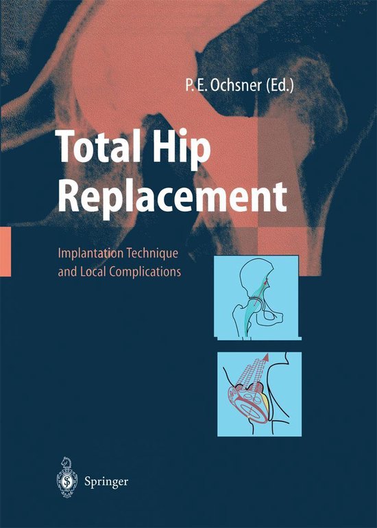 Medicine (R0) - Total Hip Replacement - cover