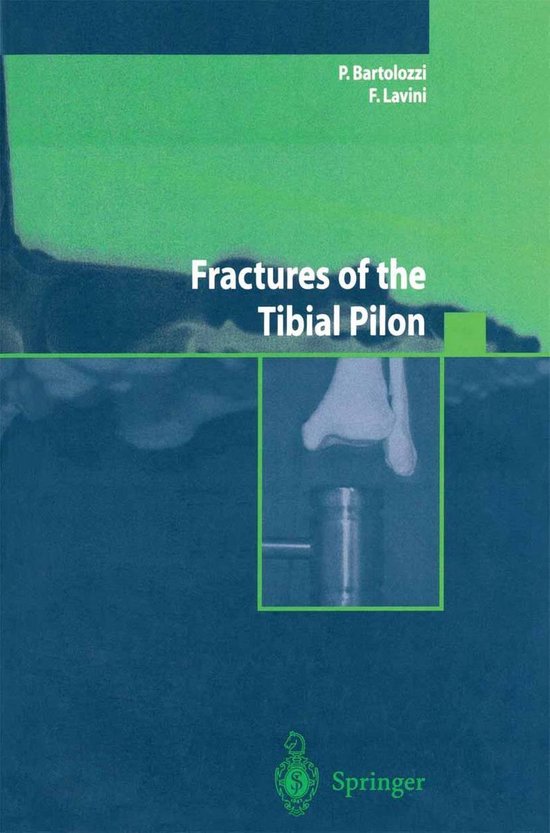 Medicine (R0) - Fractures of the Tibial Pilon - cover