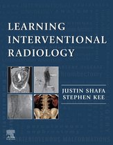 Learning Interventional Radiology eBook