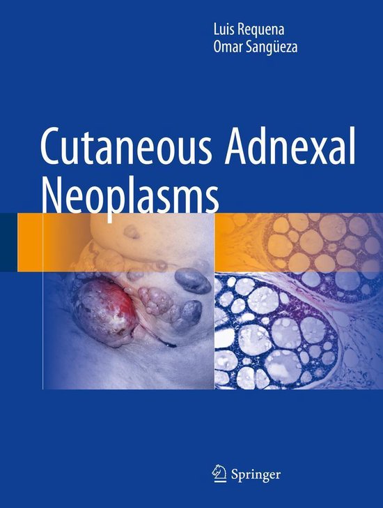 Bol Com Cutaneous Adnexal Neoplasms Ebook Luis Requena 9783319457048 Boeken