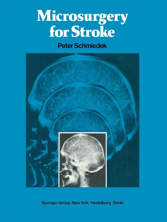 Medicine (R0) - Microsurgery for Stroke - cover