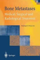 Bone Metastases