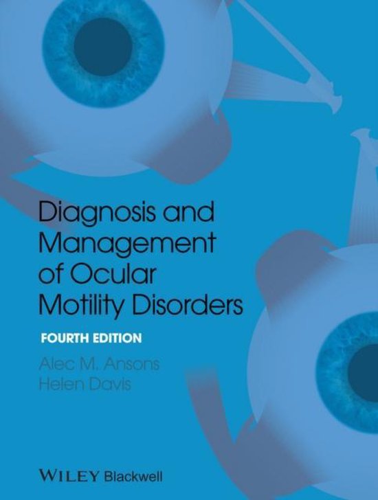 Diagnosis and Management of Ocular Motility Disorders