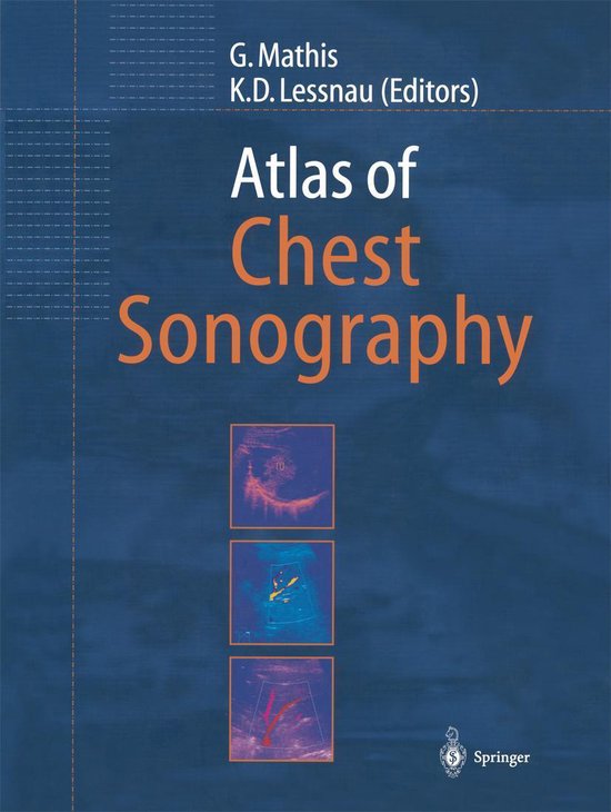 Medicine (R0) - Atlas of Chest Sonography - cover