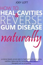 How to Heal Cavities and Reverse Gum Disease Naturally: a science-based, proven plan to heal teeth and gums using nutrition, balancing the metabolism, and natural therapies such as oil pulling