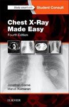 Chest X-Ray Made Easy