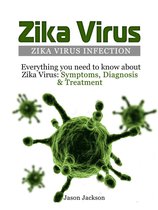 Zika Virus: Zika Virus Infection: Everything you need to know about Zika Virus: Symptoms, Diagnosis & Treatment