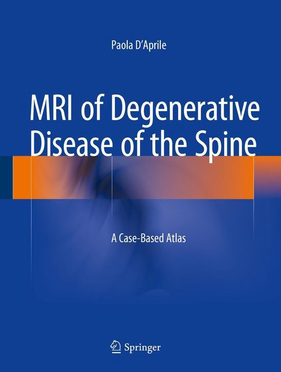 Medicine (R0) - MRI of Degenerative Disease of the Spine - cover