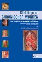 Blickdiagnose chronischer Wunden