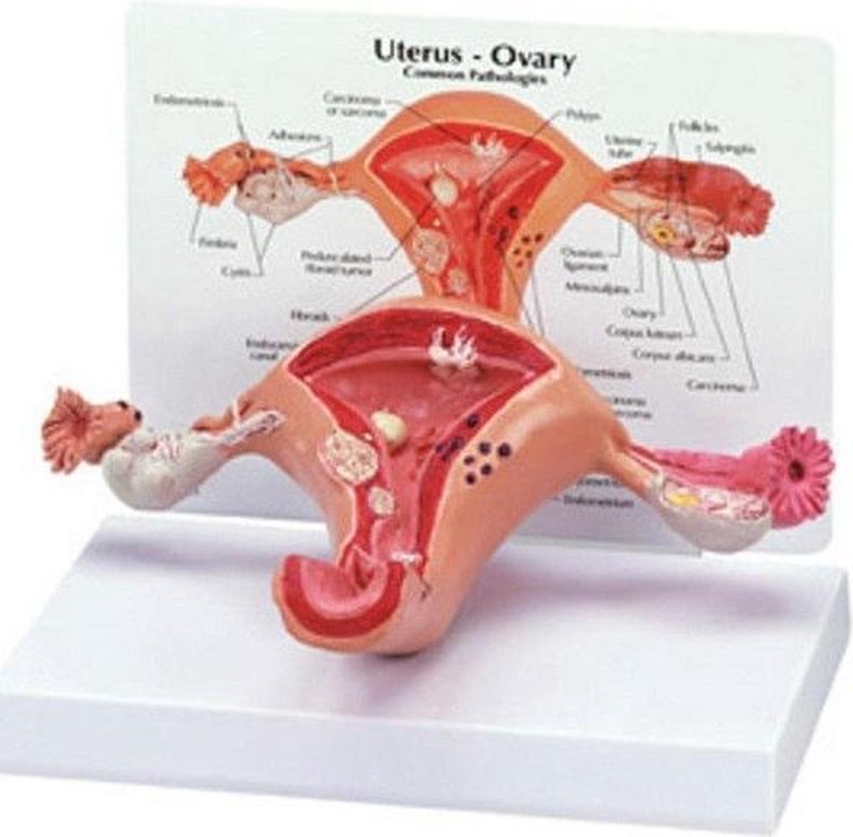 Voorbeeld Van Een Zwangere Baarmoeder Met Een Foetus Op De Foetale Plaats Omringende Anatomische Structuren Omvatten Bekken Spieren En Image383689656