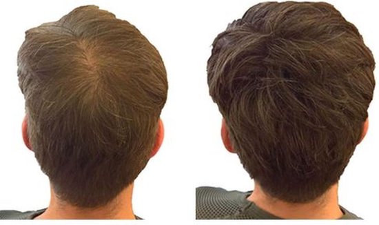 Voor en na: donkerbruin haar dat voller lijkt na gebruik van IMPERIO haarvezels.