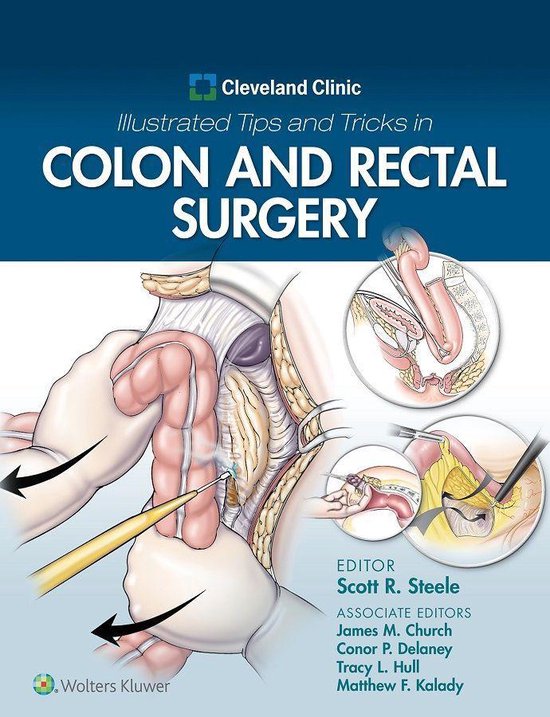 Cleveland Clinic Illustrated Tips and Tricks in Colon and Re ... - cover